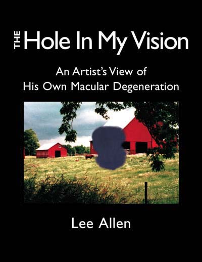 The Hole in My Vision - book cover