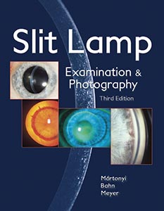 Photo Slit Lamp, Martonyi